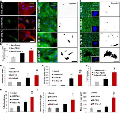 Extracellular Vesicles From 3xTg-AD Mouse and Alzheimer’s Disease Patient Astrocytes Impair Neuroglial and Vascular Components